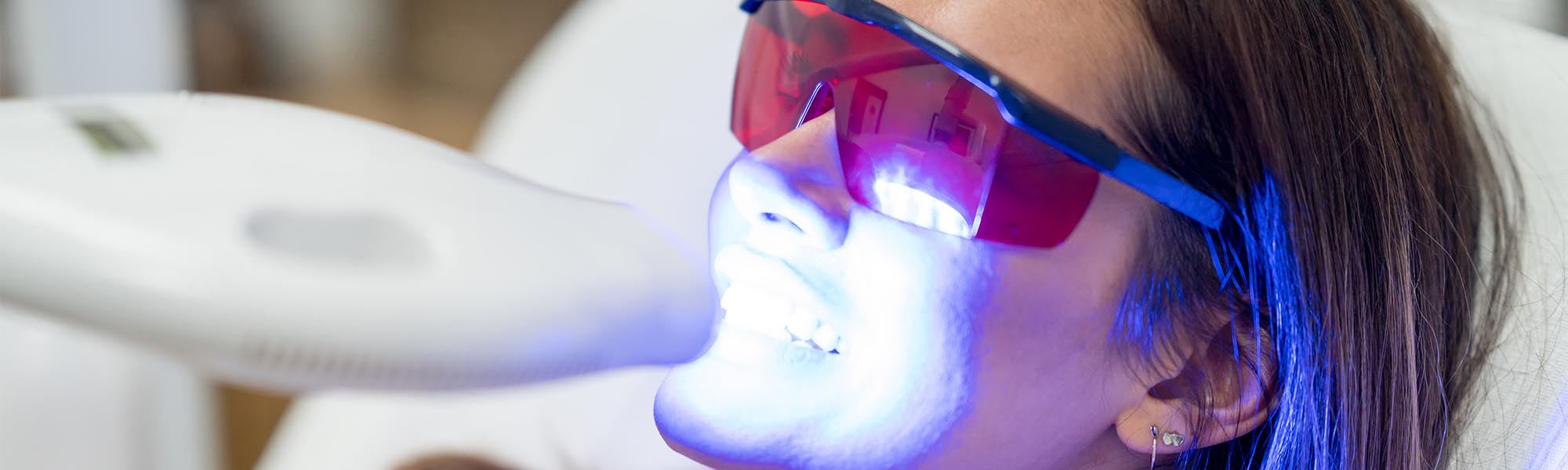 Fluoride Treatment Dentist Whittier CA