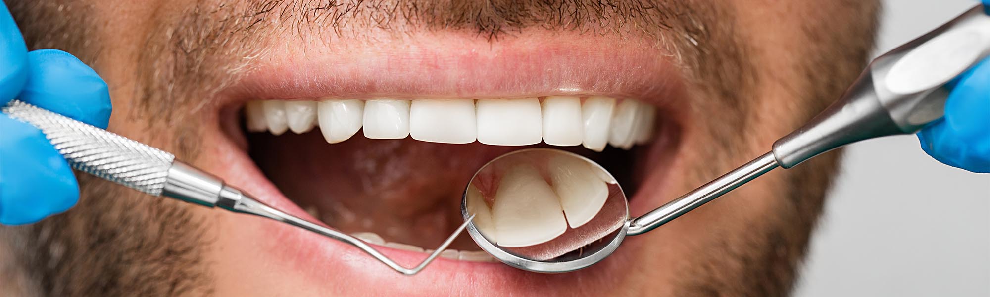Periodontics Treatment in Whittier CA
