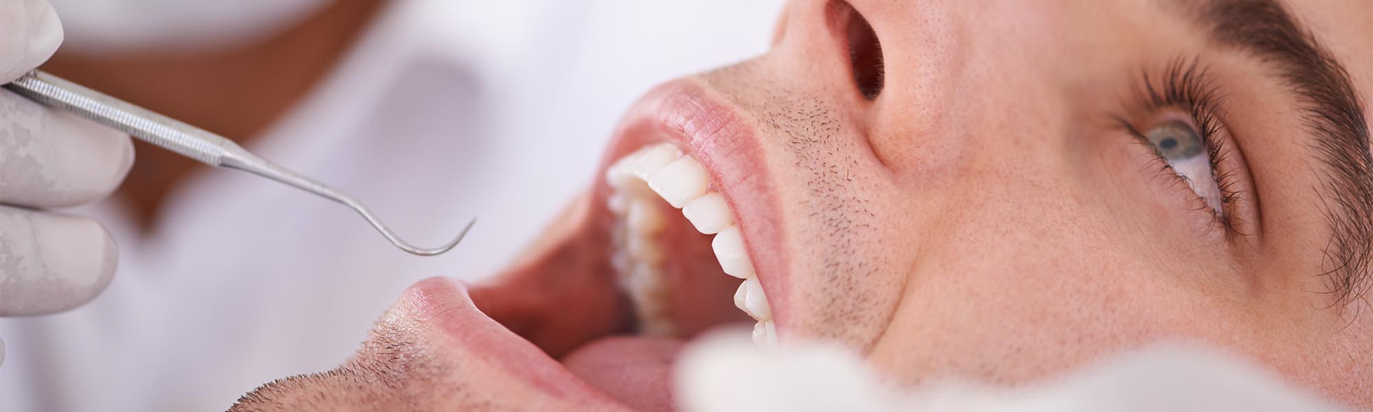 Periodontics Treatments in Whittier CA