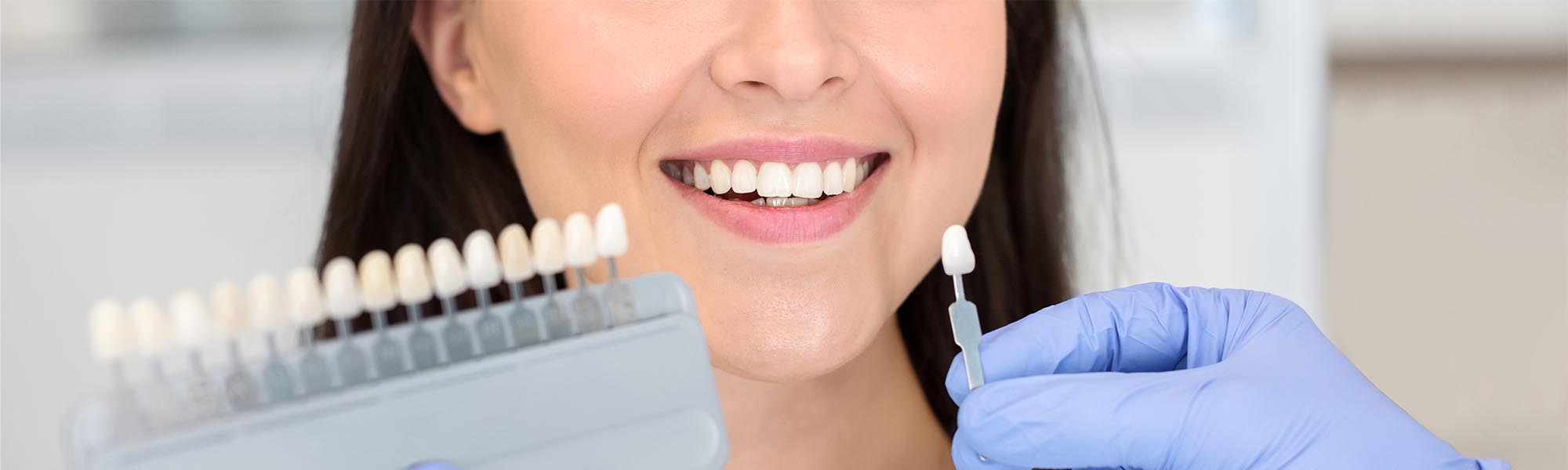 Porcelain Veneers in Whittier CA