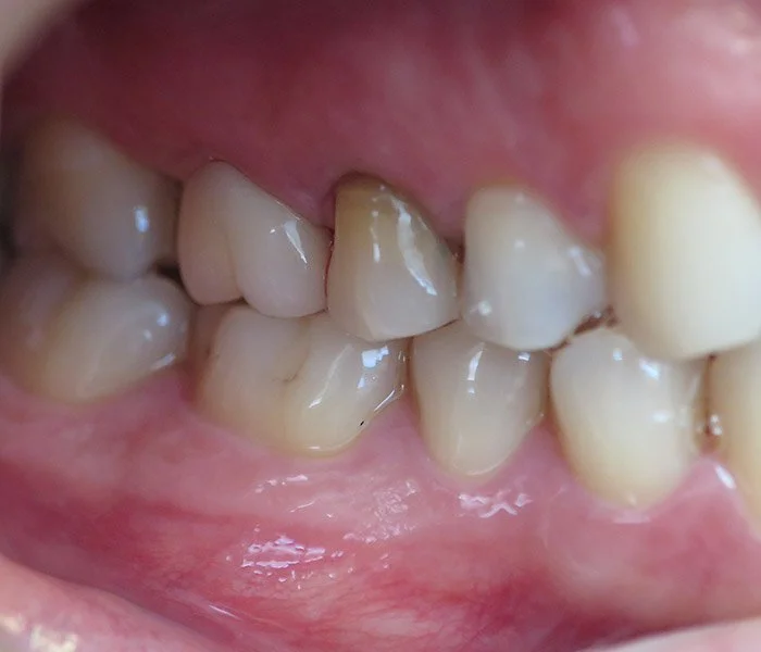emergency dentist Whittier After
